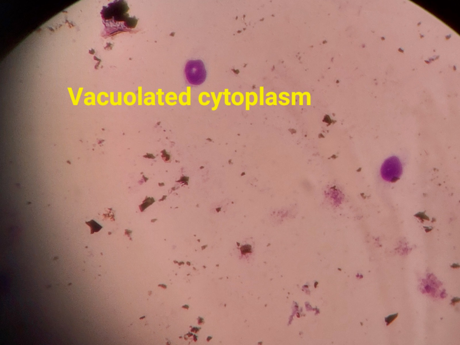 Densidade do caranguejo-uçá (Ucides cordatus) e a Contaminação por Metais nos Manguezais do Sistema Estuarino de Itanhaém (SP), Brasil.